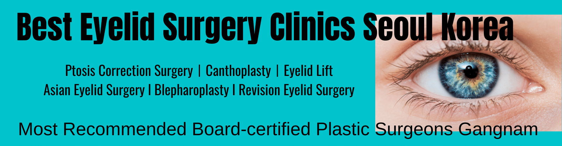 The Best 5 Cat Eye Surgery Korea